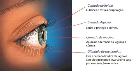 olho seco sintomas-4